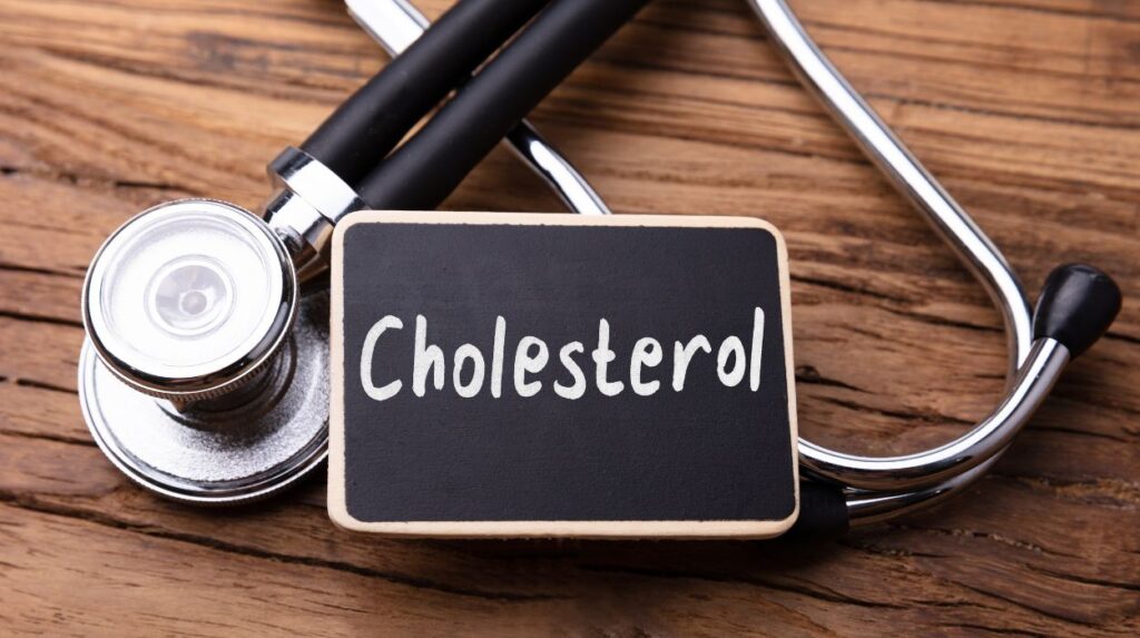 Cholesterol